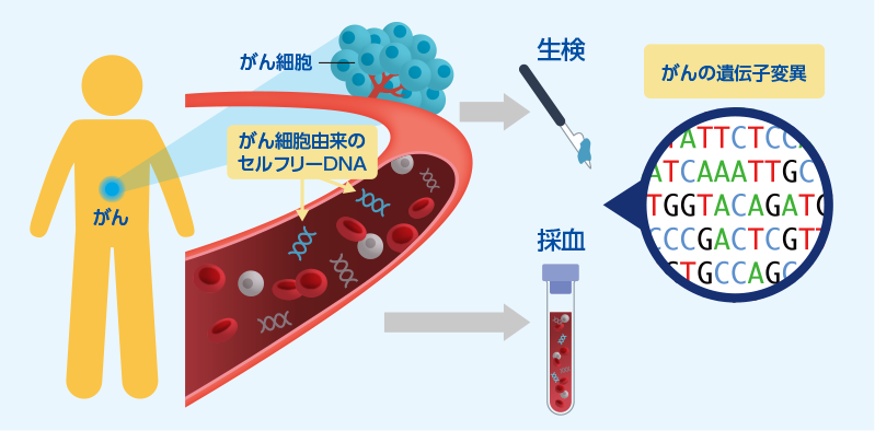 がんの遺伝子解析